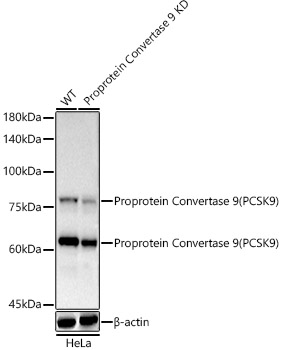 [KD Validated] Proprotein Convertase 9(PCSK9) Rabbit mAb