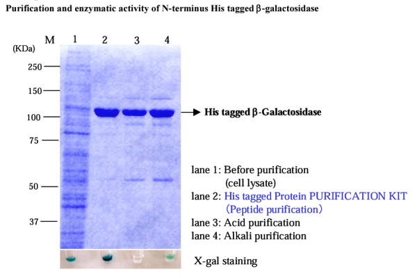 His tagged Protein PURIFICATION KIT