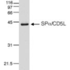 Human AIM/CD5L/SPα(Lymphocyte antigen CD5-like)
