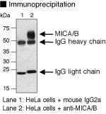 Anti-MICA/B (Human) mAb (Monoclonal Antibody)
