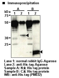 Anti-His-tag pAb-Agarose (Polyclonal Antibody)