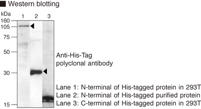 Anti-His-tag pAb (Polyclonal Antibody)