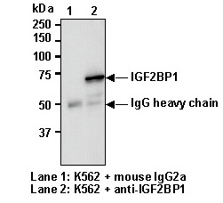Anti-IGF2BP1 (IMP1) (Human) mAb (Monoclonal Antibody)