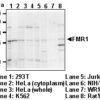 Anti-FMR1 pAb RNA IP