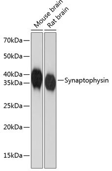 Synaptophysin Rabbit mAb - Products