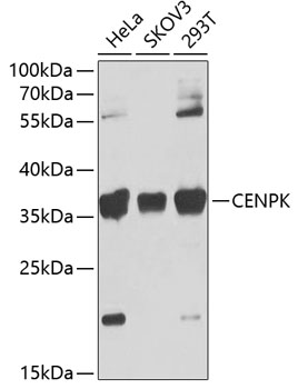 CENPK Rabbit pAb